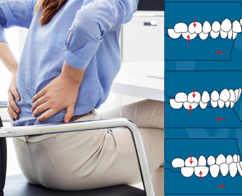 Il male alla schiena può dipendere dai denti?