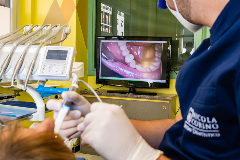 Utilizzo Tac Conebeam Studio dentistico Dott. Nicola Corino