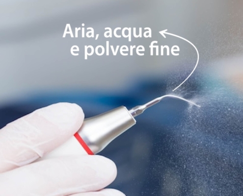 Con il trattamento Air Flow angoscia e fastidi sono solo un antipatico ricordo!